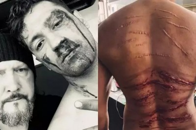 सरदार उधम:विक्की कौशल ने पोस्ट शेयर कर फिल्म में अपने घायल लुक के पीछे के शख्स का किया खुलासा