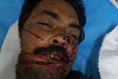 सूरज बंछोर को पीट-पीट कर मार डाला, तालाब के किनारे मिला शव; एक दिन पहले था जन्मदिन