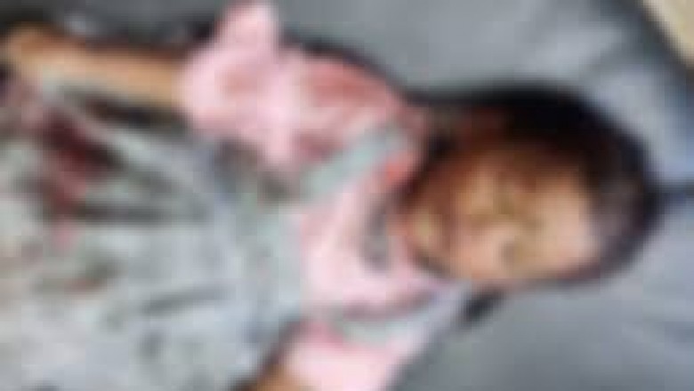 हादसे में बेटी की मौत, पिता पर FIR