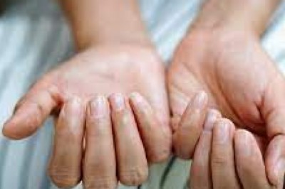 ओमिक्रॉन के नए लक्षण:त्वचा, होंठ और नाखूनों के रंग बदलना भी हैं ओमिक्रॉन के लक्षण,