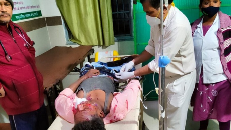 छत्तीसगढ़ के धमतरी में रविवार देर शाम तेज रफ्तार कार ने बाइक सवार युवकों को टक्कर मार दी