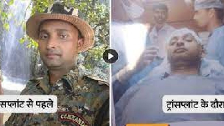पटना में एक पुलिस जवान की हेयर ट्रांसप्लांट के महज 24 घंटे बाद मौत