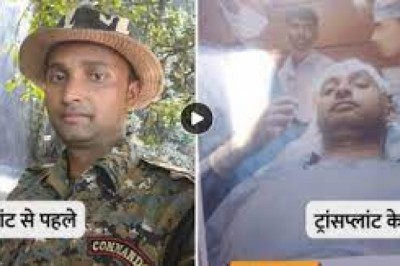 पटना में एक पुलिस जवान की हेयर ट्रांसप्लांट के महज 24 घंटे बाद मौत