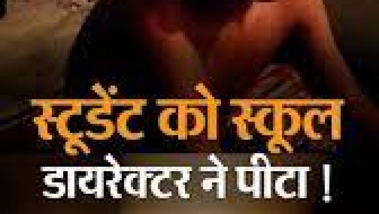प्राइवेट स्कूल के डायरेक्टर ने 8वीं क्लास के छात्र की बेरहमी पीटा ,