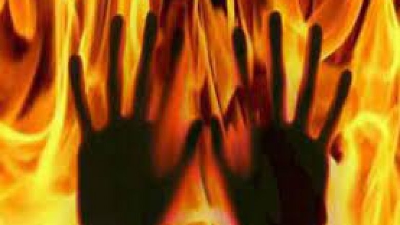 बिजली गुल हुई तो चिमनी जलाकर रैक में रख दी,अचानक पलंग पर गिरी, 90 फीसदी झुलसी महिला