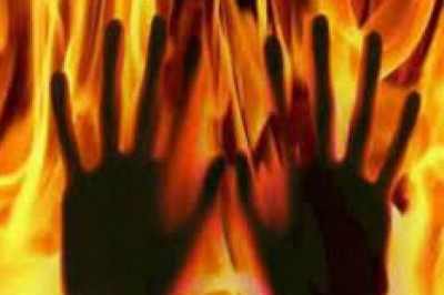 बिजली गुल हुई तो चिमनी जलाकर रैक में रख दी,अचानक पलंग पर गिरी, 90 फीसदी झुलसी महिला