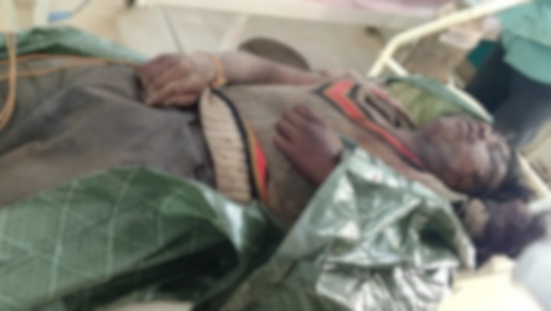 जवानों ने पहुंचाया अस्पताल,जानलेवा हमले के बाद जिस ग्रामीण को मरा समझकर नक्सली छोड़ गए...