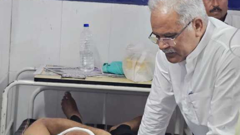 पूर्व सी एम भूपेश बघेल पहुंचे हमले में घायल पत्रकार किशन हिरवानी से मिलने...