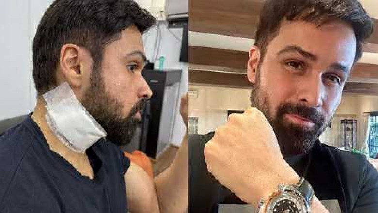 शूटिंग के दौरान घायल हुए इमरान हाशमी, 45 वर्षीय एक्टर की गर्दन पर लगी गंभीर चोट...