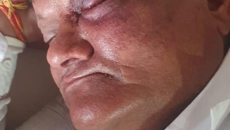 अम्लेश्वर  में रहने वाले शिव महापुराण कथा के आयोजक में से एक आयोजक पवन खंडेलवाल के साथ हुई मारपीट...