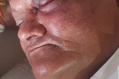 अम्लेश्वर  में रहने वाले शिव महापुराण कथा के आयोजक में से एक आयोजक पवन खंडेलवाल के साथ हुई मारपीट...