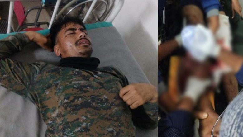 छत्तीसगढ़ के बीजापुर में  2 जवान नक्सलियों द्वारा लगाए गए IED की चपेट में हुए  घायल रायपुर किया गया रेफर