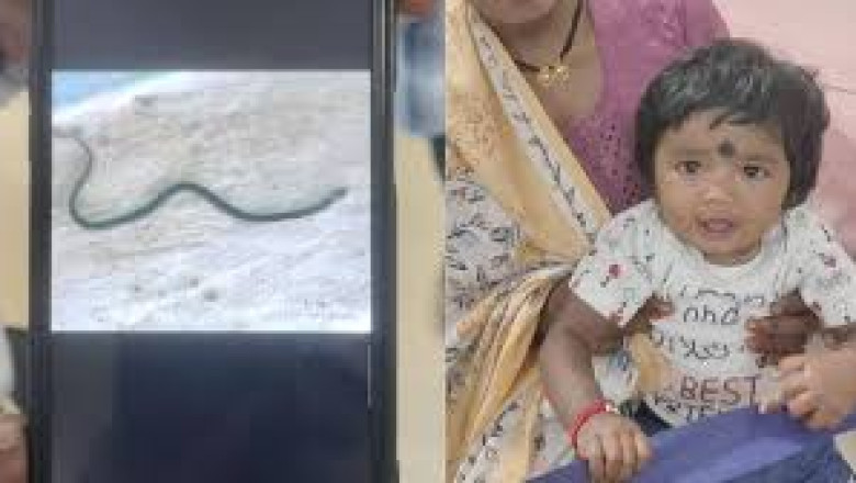 डॉक्टर हैरान : 9 माह की मासूम बच्ची खिलौना समझ कर सांप से खेल रही थी ,बच्ची के काटते ही मर गया ज़हरीला सांप...