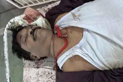 दुर्ग में कार ने कुचला, सरगुजा में बाइकों की भिड़ंत: सड़क हादसों में 4 की मौत